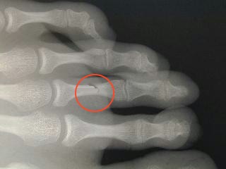 radiographie coll&egrave;ge Jules Renard 53000 Laval