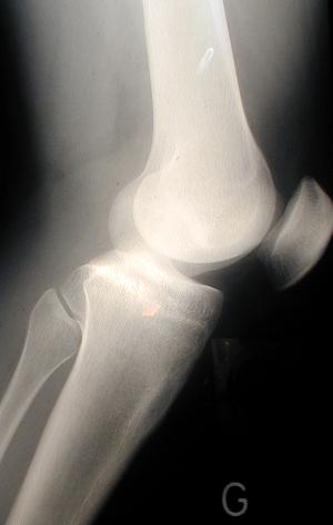 radiographie coll&egrave;ge Jules Renard 53000 Laval