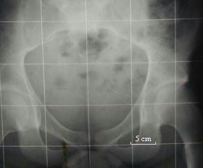 radiographie coll&egrave;ge Jules Renard 53000 Laval