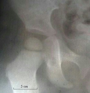 radiographie coll&egrave;ge Jules Renard 53000 Laval