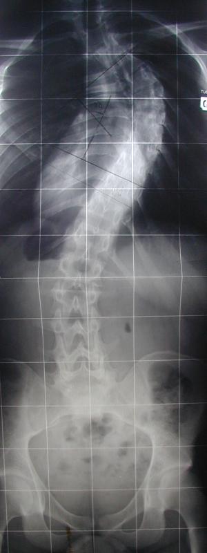 radiographie coll&egrave;ge Jules Renard 53000 Laval