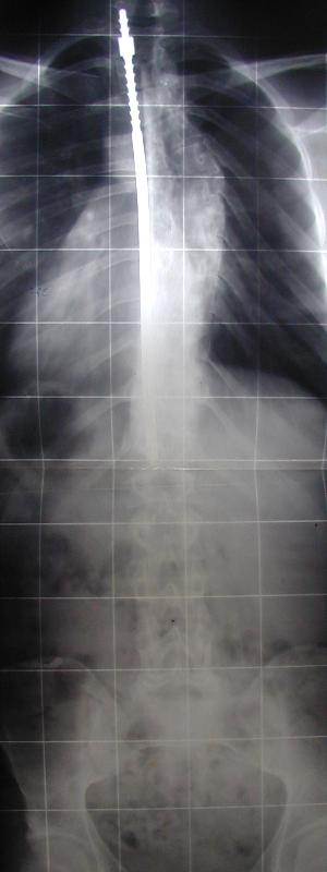 radiographie coll&egrave;ge Jules Renard 53000 Laval